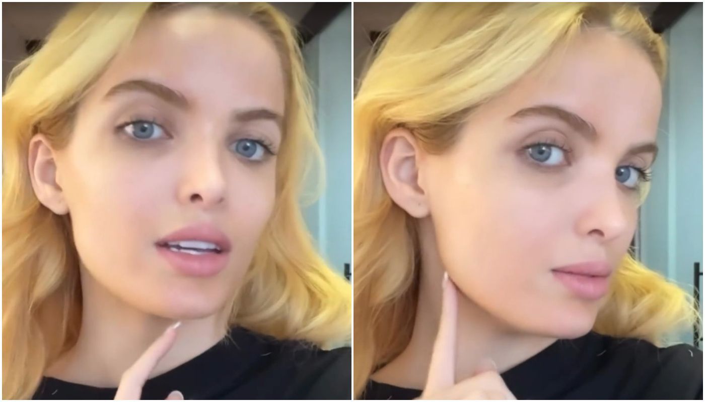 Giovanna Chaves faz harmonização para ficar parecida com Angelina Jolie