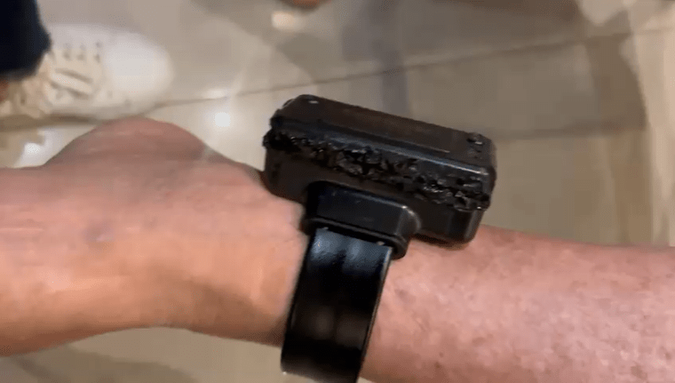 Análise: Tornozeleira danificada complica estratégia da oposição