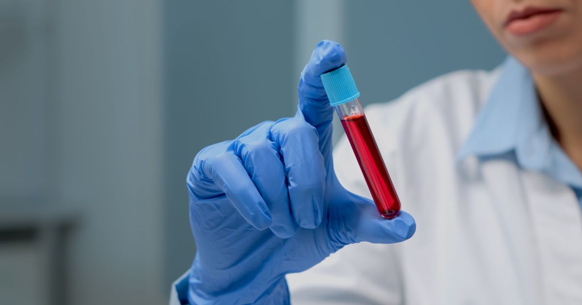 Exames ajudam a prevenir lesões esportivas antes mesmo da dor surgir