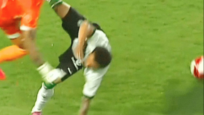 Imagens fortes: atacante do Coritiba fratura o braço em jogo do Paranaense