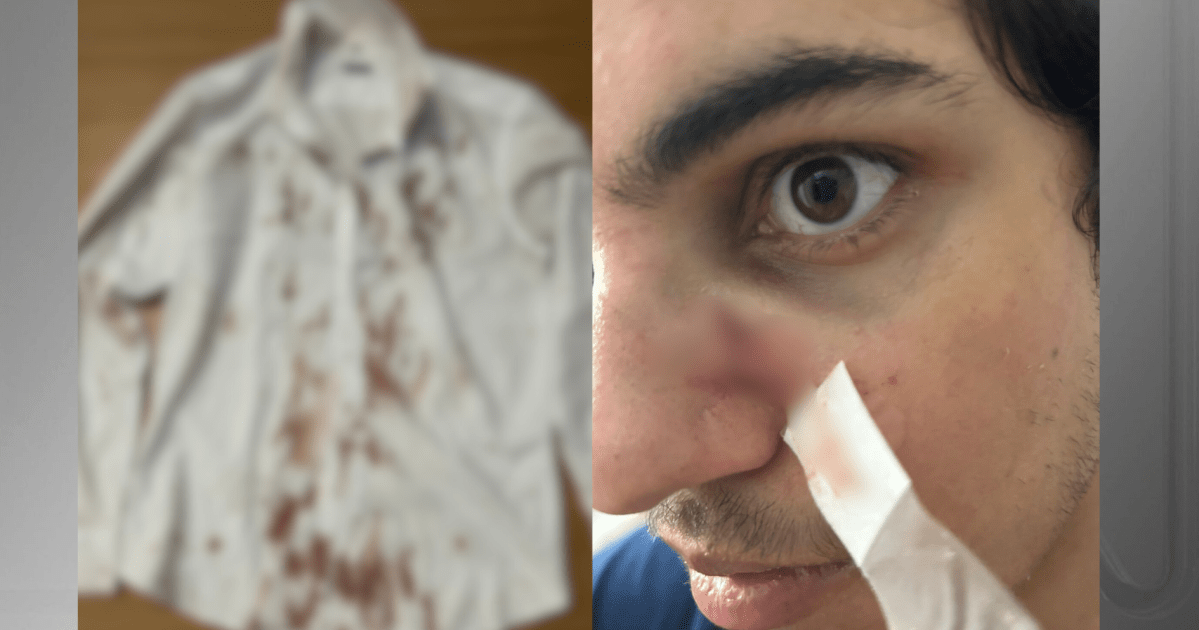 Turista é assaltado e agredido durante Festival Virada Salvador, na Bahia